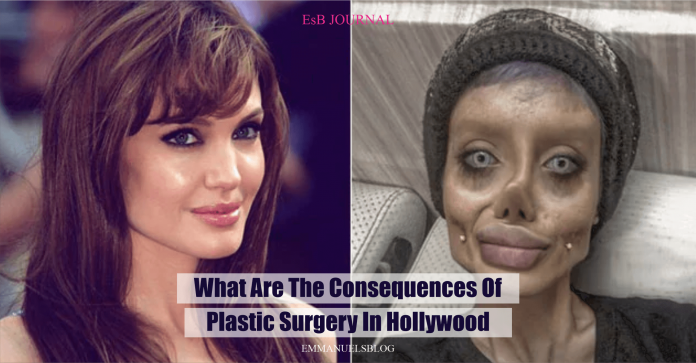 What Are The Consequences Of Plastic Surgery In Hollywood?