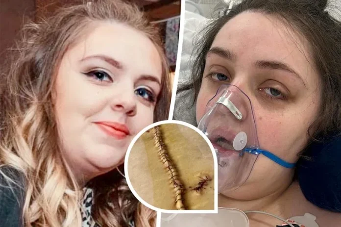 A 23-Year-Old Mother Found Herself Battling For Survival In A Coma Following A 'Nightmarish' £1,500 Weight Loss Operation In Turkey